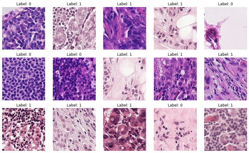 ../../_images/use-cases_computer_vision_1-metastases-detection-train-model_15_0.png