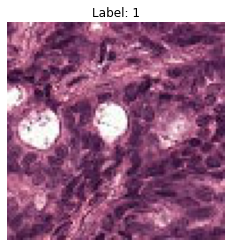 ../../_images/use-cases_computer_vision_3-metastases-detection-deploy-predict_16_0.png